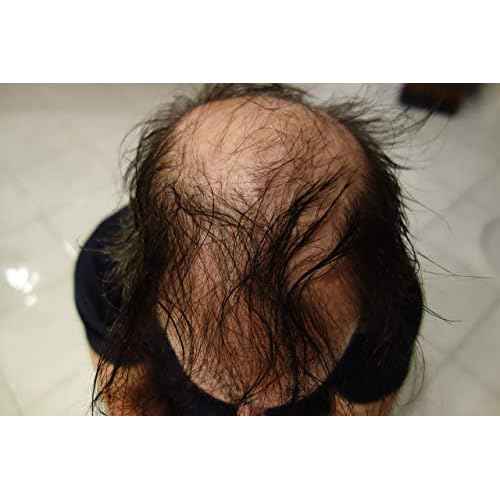 Hair Building Fibers 200 Grams 7 Oz. With Bottle By Finally Hair 50g*4 (Light Grey and Pepper)