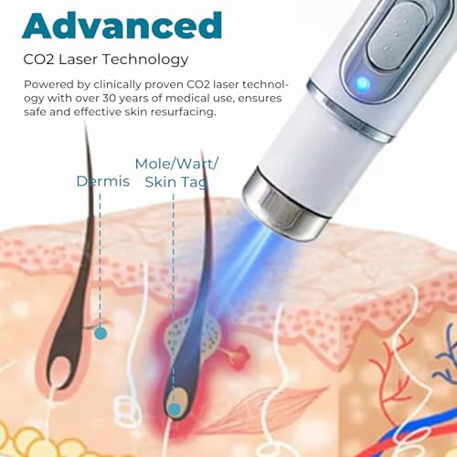 Blue Light Therapy Pen for Acne, Scars, and Skin Tightening