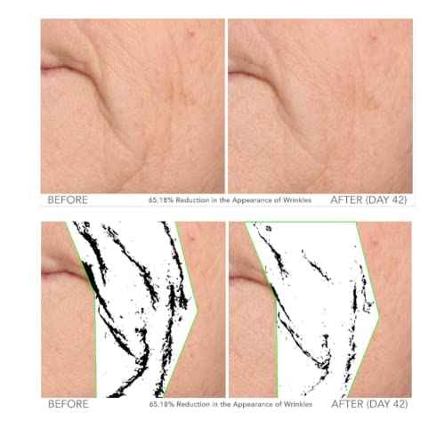 Serious Skincare - Beyond Intensive Vitamin C Serum for Face - 60 Day Facial Treatment for Healthy Glowing Skin and Brightening - Smoothes Lines, Pores and Fades Dark Spots - 2 Piece Anti-Aging Set