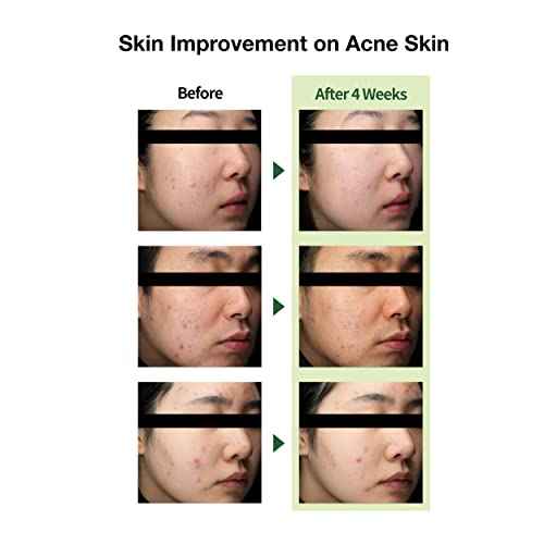 Lightweight Trouble Care Daily Moisturizer Watery Soothing Cream Centella Asiatica CICA Green Flavonoid - 1.7Oz Non-Clogging Oil Free Acne-Prone Skin Calm Redness Rosacea Korean THE LAB Blanc Doux