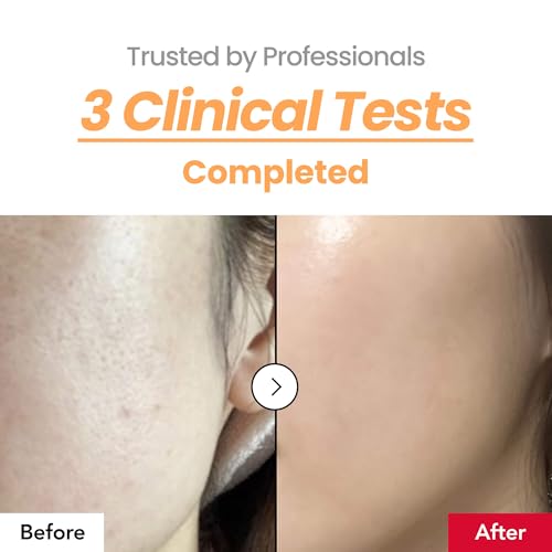 Skin Texture Booster 214% Essence ? Deep Hydration, Glass Skin, Triple Hyaluronic Acid, Collagen & Retinol, Lightweight & Non-Sticky, Visibly Plumping Effect, Korean Skincare, 5.07 fl oz