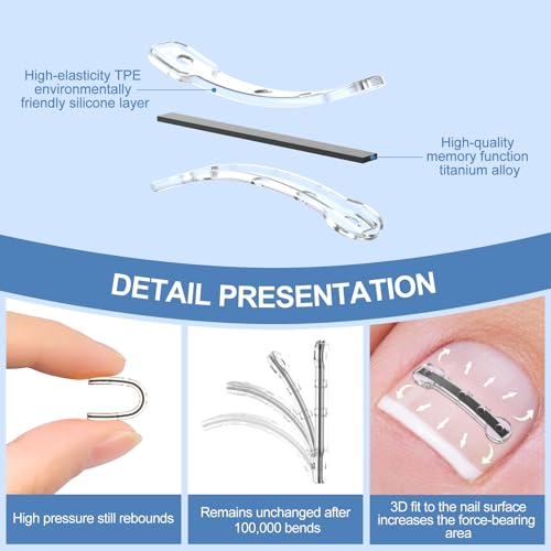 12Pcs Ingrown Toenail Corrector Strips for Curved Toenail Quick Relief,4 Multi-Sizes Ingrown Toenail Treatment Relief Tools Kit for Home Use