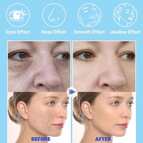 TUMAKOU High Frequency Facial Wand with 4 Neon + Argon Tubes