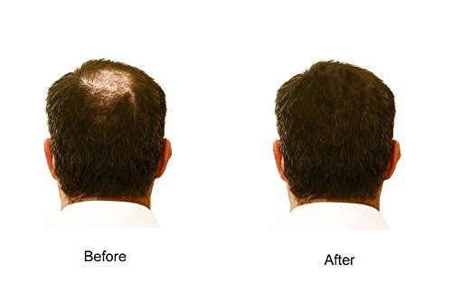 My Secret Hair Enhancer Medium Brown 5oz (3-Pack)