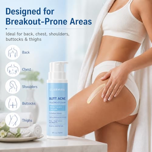 Body Acne Cream with 2% Salicylic Acid, Tea Tree Oil & Chamomile
