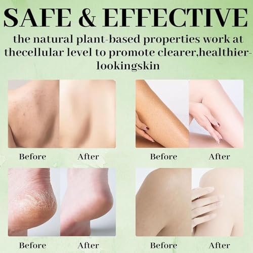 Tea Tree Soap, Relief Soap Bar Infused with Tea Tree Oil, Natural Foot & Body Soaps for Healthy Skin, Addresses Foot Discomfort and Skin Irritations, Gentle Exfoliating Bar Soap for Men Women