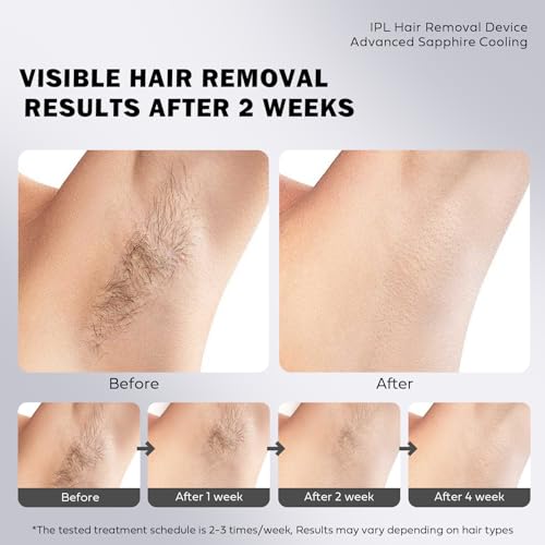 IPL Laser Hair Removal Device for Women - Painless, Fast Results in 2 Weeks