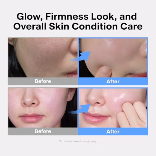 THOME Facial Massager for Glass Glow Skin | Firms & Smooths