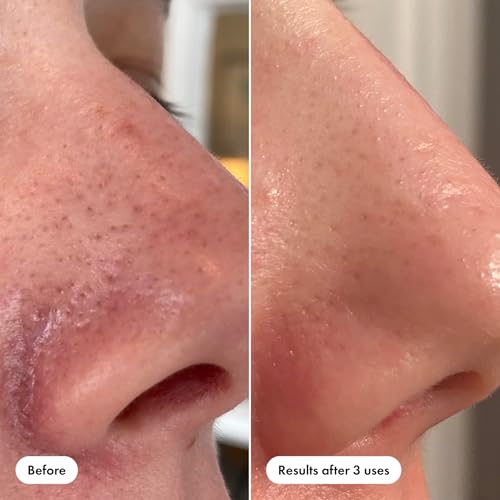Hero Cosmetics Pore Release Blackhead Clearing Toner 3.38oz