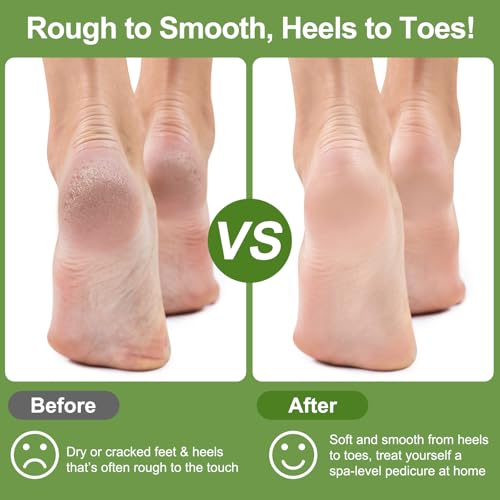 KuuCare Natural Lava Pumice Stone 3 Pack - Foot Callus Remover Exfoliator