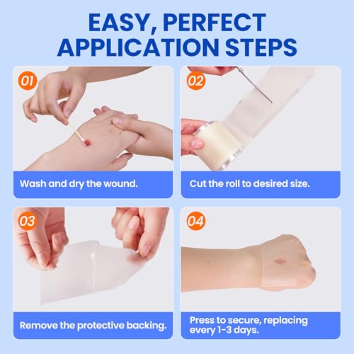 Hydrocolloid Roll Bandages - Medical Grade Skin Protection (2in x 5ft)