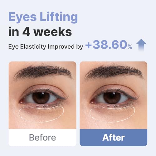 AROCELL Wrinkle Solution Eye Cream 0.5 fl oz ? Korean Under Eye Cream with Collagen & Galvanic Care, Hydrating Moisturizing Eye Moisturizer, Elasticity Boosting, Gentle Non Sticky Daily Eye Care
