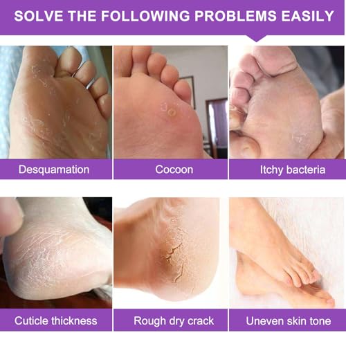 ALIVER Exfoliating Foot Peeling Mask 5-Pack - Lavender Foot Peel Socks