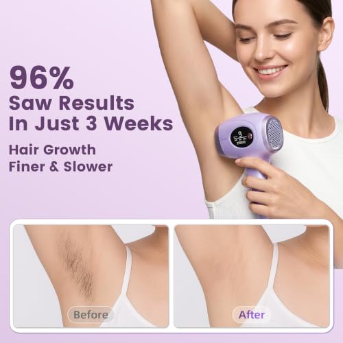 IPL Laser Hair Removal Device for Women at Home - Up to 96% Hair Reduction