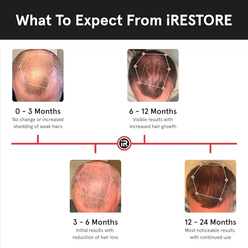 iRestore Essential Laser Hair Growth System - FDA Cleared Hair Loss Treatments for Men & Women & Hair Growth Products for Men with Thinning Hair, Hair Regrowth Treatments Laser Cap, Red Light Therapy