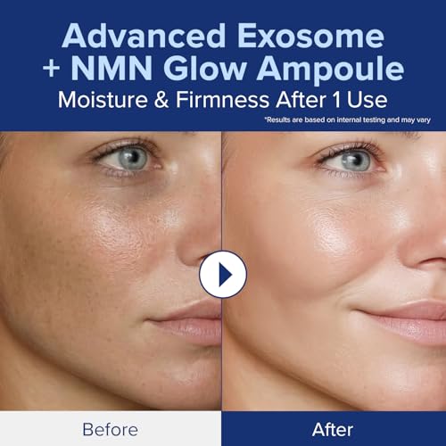 idplacosmetics EXO-V Plus Ampoule 1.01 fl.oz (30ml) ? Korean Microneedling Serum for Smoother, Plumper Skin, 99.9% 100.4 nm Encapsulated Exosome + NMN, for Microneedle Roller (250?m)