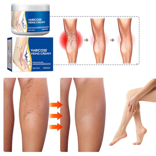 Varicose Veins Cream for Legs, Gentle Soothing Skin Cream for Legs, Moisturizing Skin Care, 1.76 Oz (2PCS)