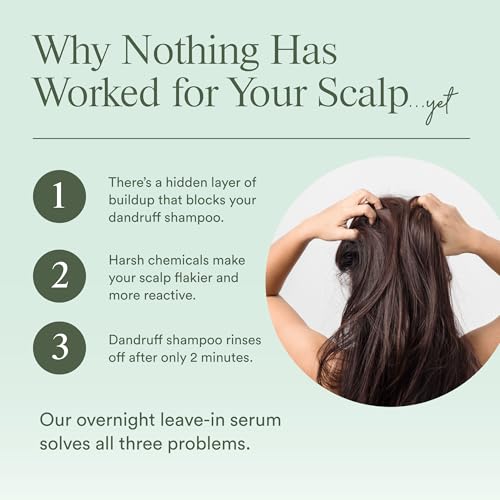 Dermazen Calming Serum for Seborrheic Dermatitis - 4oz