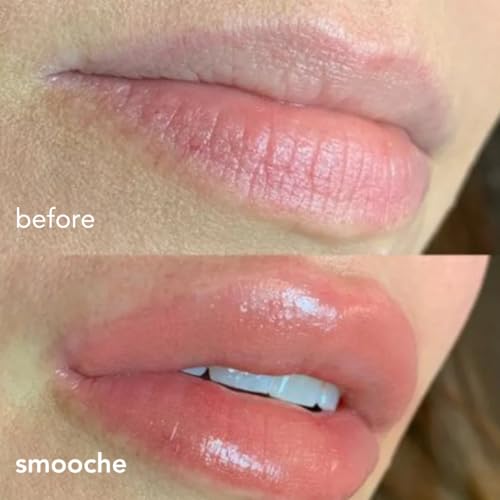 Smooche Lip Plumper with Hyaluronic Acid – Fuller Lips