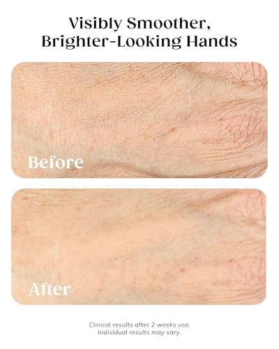 KAPLAN MD Anti-Aging Hand Cream with Vitamin C & Diamonds