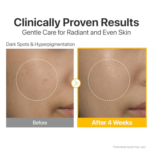 Numbuzin No.5 Vitamin Serum with Tranexamic Acid 4% & Niacinamide