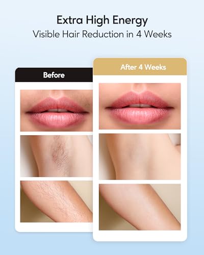 IPL Hair Removal Device with Ice Cooling Technology for Face & Body