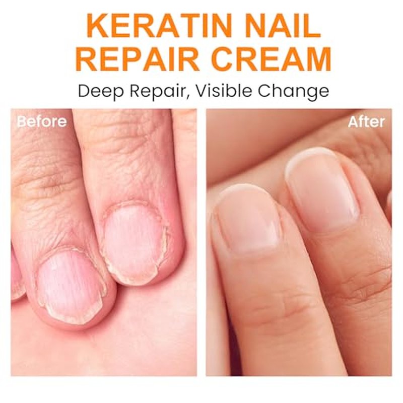 Cuticle Cream with Keratin – Nail Repair & Hydration, 60g (2-Pack)