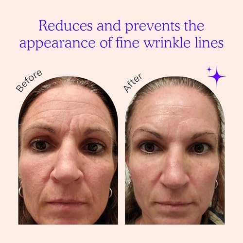 BLUMBODY Anti-Wrinkle Face Patches - 30 Day Supply