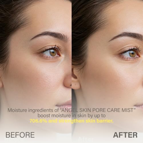 KEYTH ANGEL SKIN PORE CARE MIST (150ML, 5.07 FL.OZ.) / Sebum Control, Pore Tightening, Wrinkle Improvement, Avocado Esters, Orthosiphon Stamineus Extract