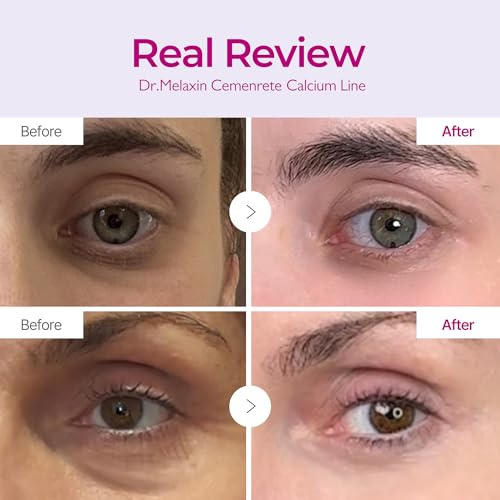 Dr.Melaxin Cemenrete Calcium Intense Firming Cream 50ml (1.69 fl oz) ? Rebornic 10,000ppm, Niacinamide & Hydrolyzed Elastin, Lifting & Elasticity Face Cream for Sagging Skin