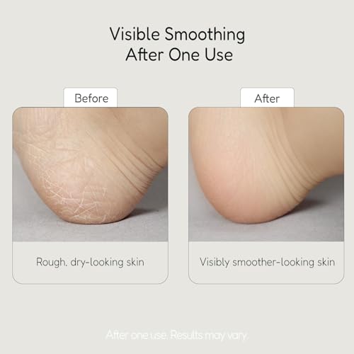 BuffOut Callus Eraser Exfoliating Gel | Feet & Body Scrub