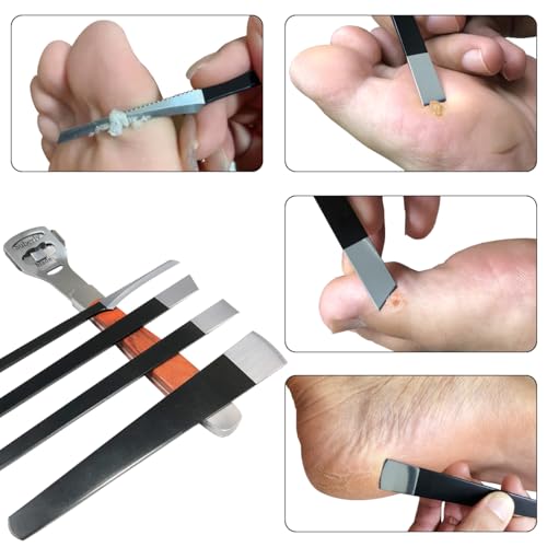 Professional Stainless Steel Foot Callus Shaver Set - 36 Pcs Pedicure Kit