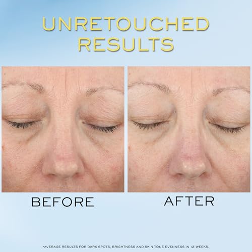Lancôme Supra Screen Invisible Serum Sunscreen SPF 50+ - Hydrating Anti-Aging Formula