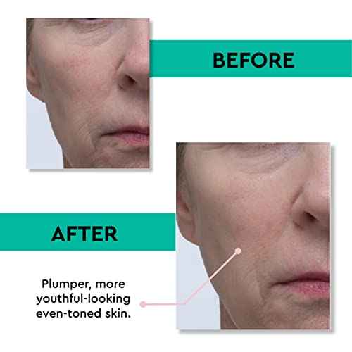 Clark's Botanicals Retinol Rescue Overnight Cream ? Clinically Proven to Reduce Redness, Smooth Fine Lines & Hydrate with Time-Released Retinol, Vitamin C + Hyaluronic Acid, 60ml