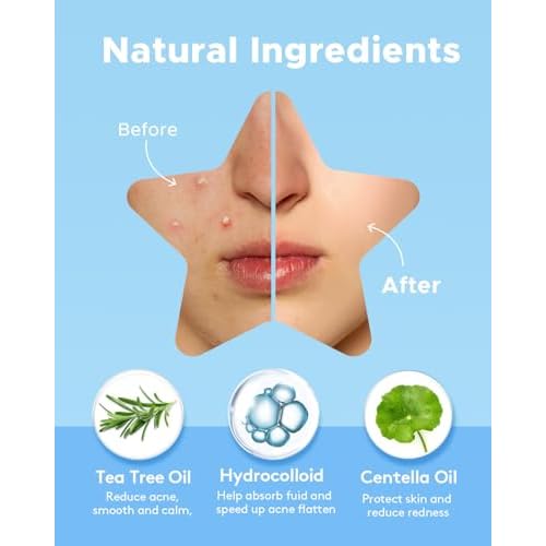 LitBear Acne Patch Pimple Patch, 6 Colors 336 Dots Star Pimple Patches with Tea Tree Oil & Centella Oil, Hydrocolloid Acne Pimple Patches for Face Cute Zit Patches Pimple Stickers Acne Dots
