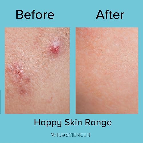 Wild Scicen Lab HAPPY BALANCE AHA + BHA + Zinc Clarifying Essence for Acne-Prone Skin