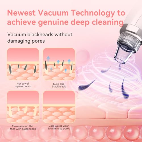 Blackhead Remover Pore Vacuum | USB Rechargeable with 5 Suction Levels