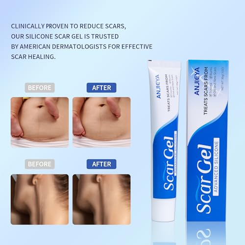 Silicone Scar Gel Advanced Scar Cream for Old & New Scars, Fades C-Section, Keloids, Stretch Marks, Burns, Surgeon Recommended Scar Repair
