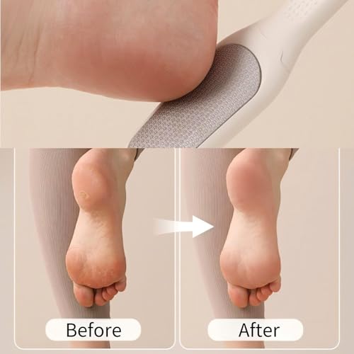 Detachable Foot File Callus Remover Double Sided Pedicure Tool