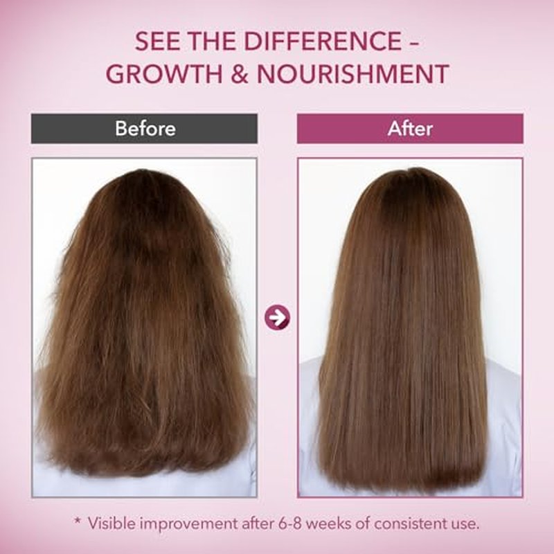 Onion & Rosemary Hair Growth Conditioner - Biotin Infused, 16.9 Fl Oz