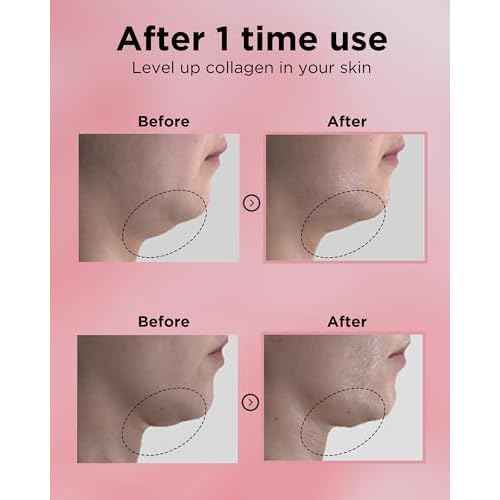 EASYDEW DW-EGF 55% Collagen Silkream Ampoule- Korean Facial Serum for Firmness & Elasticity with EGF Peptides, Amino Acids - Day & Night Age-Defying Silky Smooth Skincare, 1.86oz.