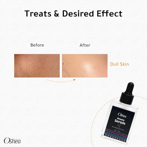 Beauty Serum, 30ml, Hyaluronic Acid, Natural Ingredients, Dark Spot Corrector, Skin Brightening, Hydrating Face Serum, Anti-Pigmentation, Even Skin Tone, Lightweight, Fast Absorbing
