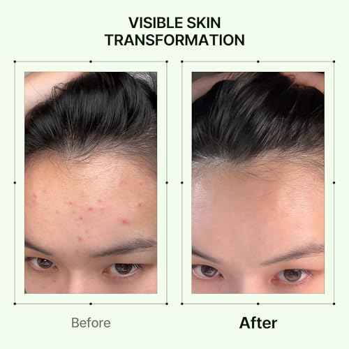 Mugwort Soothe in Toner 5.41 fl.oz. 160ml ¤ÓpH5.5 Calming, Soothing, Hydrating Spray Toner