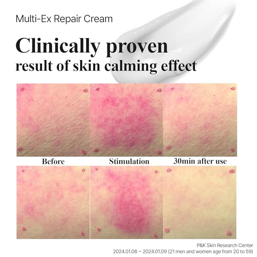 Multi-Ex Repair Cream 50ml ? Korean Face Moisturizer with Niacinamide & EGF | Skin Repair Cream for Sensitive Skin | Soothing Facial Moisturizer for Women | Hydrating Moisture