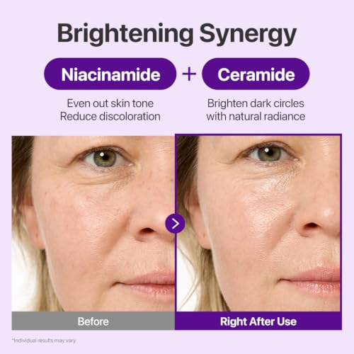numbuzin No.9 NAD+ Retinal Eye Cream for Anti-Aging & Firming