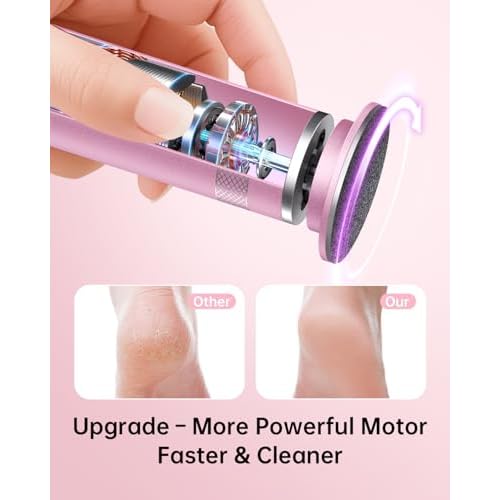 Electric Foot Callus Remover, Upgrade Electric Foot File Callus Remover for Feet, Adjustable Speed Foot File with 60 Pcs Sandpaper Discs, Foot Scrubber for Cracked, or Tough Skin and Calluses, Pink