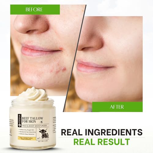Beef Tallow for Skin ? Organic Whipped Beef Tallow Honey Balm | Tallow & Honey Balm for Face | Softening Skin Moisturizer for Sensitive, and Dry Areas | Natural Beef Tallow Skincare - 4.2oz/120g Jar