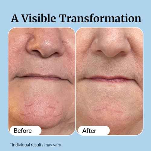 Vibriance Super C Serum for Mature Skin - All-in-One Vitamin Formula Hydrates, Firms, Lifts, Smooths, Targets Age Spots, Wrinkles, 1 fl oz - Pack of 3