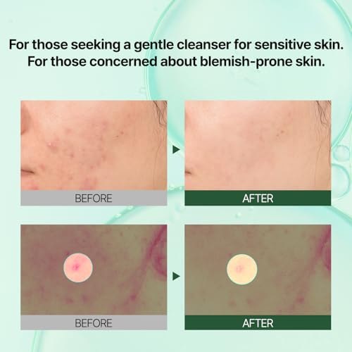 PONGDANG Pore Deep Clean Bubble Cleanser 5.11 fl.oz | Facial Foam for acne-prone skin | Zero Irritation | Sebum Control & Hydrating Wash | Korean Skin Care