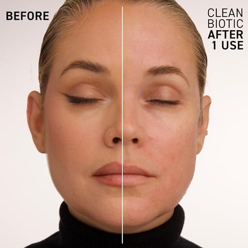 Dr. Brandt Clean Biotic - pH-Balancing Yogurt Cleanser - Melts Away Dirt, Debris, Pollution, Makeup, Sunscreen & Excess Oil - 3.5 fl oz